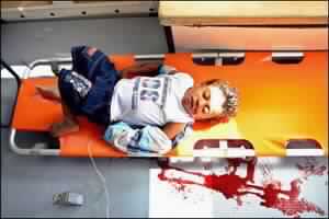 عندما يتدنى الإعلام